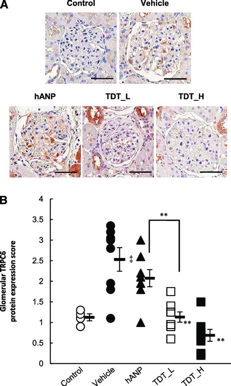 TDT Reduced Glomerular Expression Of TRPC6 Protein In DS Rats