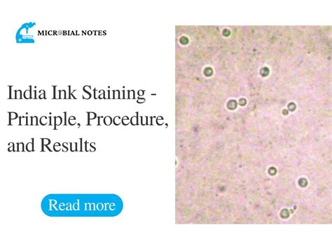 India Ink Staining - Principle, Procedure, and Results - Microbial notes