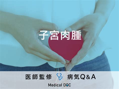 「子宮肉腫」を発症すると現れる初期症状はご存知ですか？医師が監修！ Medical Doc