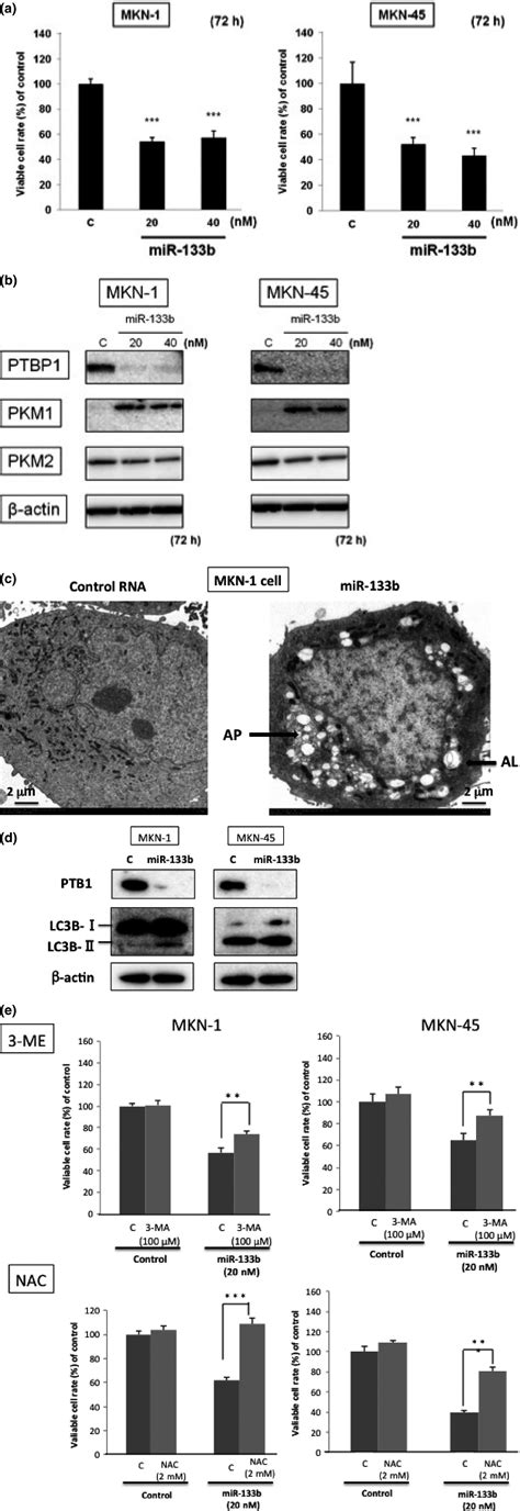 Mir‐133b Inhibits Growth Of Human Gastric Cancer Cells By Silencing