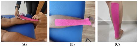 Jcm Free Full Text The Time Based Effects Of Kinesio Taping On