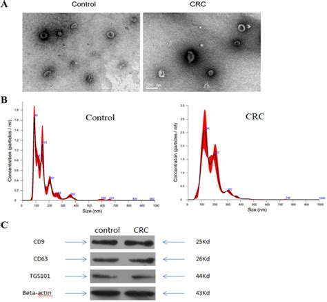Characterization of exosomes isolated from plasma. (A) Transmission ... 