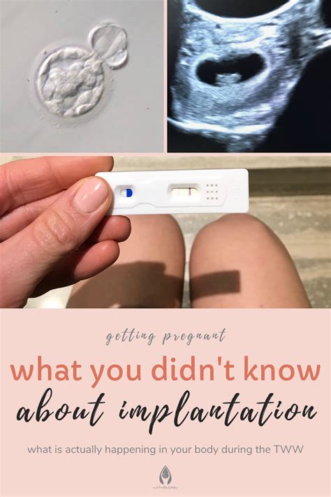 Signs And Symptoms Of Implantation After Embryo Transfer