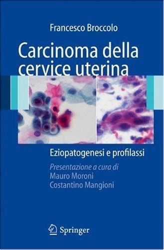 Carcinoma Della Cervice Uterina Milano Zone