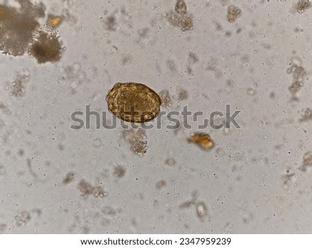 Free Lumbricoides Stock Photos Stockvault Net