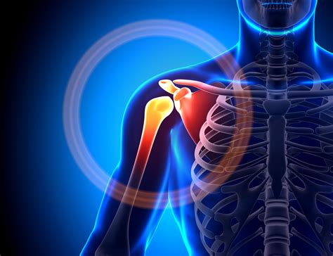 Common Shoulder Injuries Nebraska Orthopaedic Center