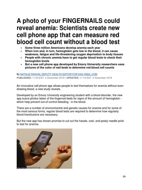 A Photo of Your FINGERNAILS Could Reveal Anemia | PDF | Anemia | Hemoglobin