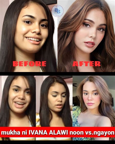 SHOCKING ️LEAKED PHOTOS OF IVANA ALAWI BEFORE PLASTIC SURGERY UNCOVERED