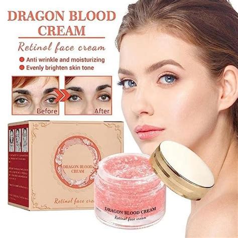 Dengwang Dragon Blood Easy Cream Dragon Blood Cream Placenta De