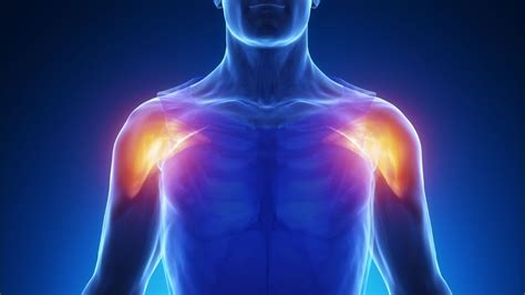 Shoulder Pain Bursitis Symptoms