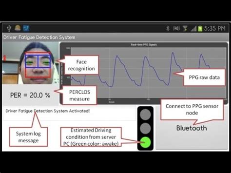 Eccessiva Sonnolenza E Sicurezza Stradale 1 YouTube