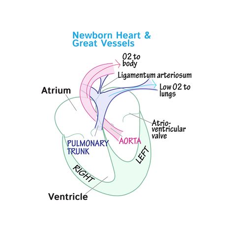 Embryology Glossary Congenital Cardiac Right To Left Shunts Draw It