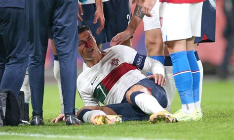 Cristiano Ronaldo suffers bloody injury in 4-0 Portugal win - Futbol on ...