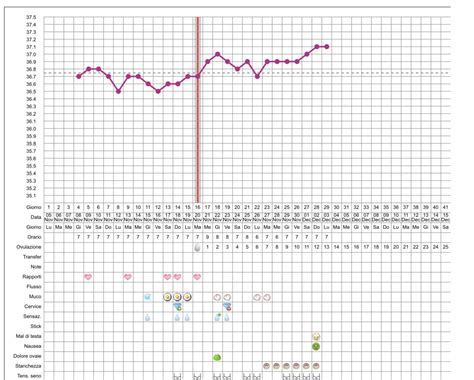 Gr Ficos De Temperatura Basal En El Embarazo Embarazo Y Fertilidad