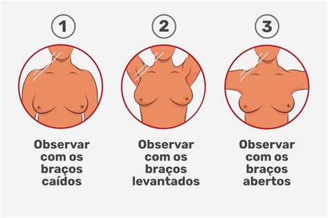 Como fazer o autoexame de mama e sinais de alerta Tua Saúde