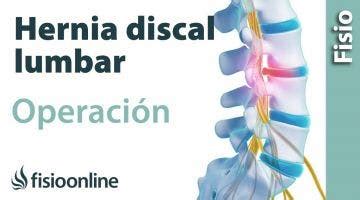 Ejercicios De Pilates Recomendado En Caso De Hernia Discal Lumbar