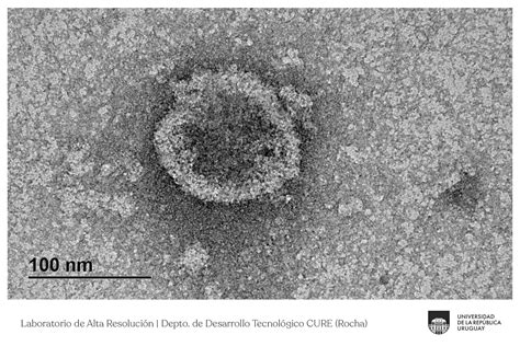 Publican primeras imágenes del SARS CoV 2 tomadas en Uruguay Otra Cabeza