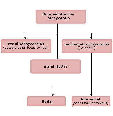 SVT Classification – RCEMLearning India