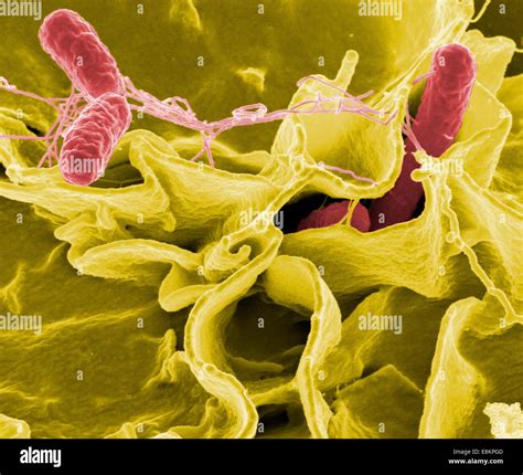 Avvelenamento Da Salmonella Immagini E Fotografie Stock Ad Alta