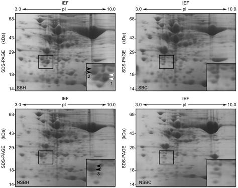 Two Dimensional Gel Electrophoresis Of Total Protein Isolated From