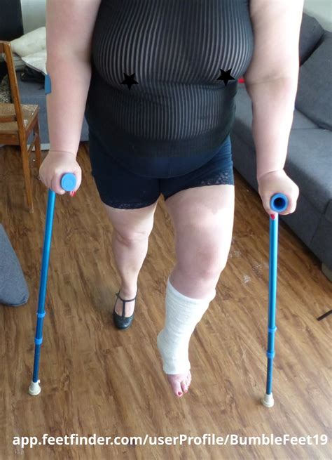 More Leg Cast Foot Fetish And Bbw Belly Show Off Nude Pics XHamster