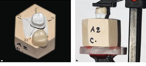 Pdf Comparison Of Marginal Fit Of Lava Cad Cam Crown Copings With Two