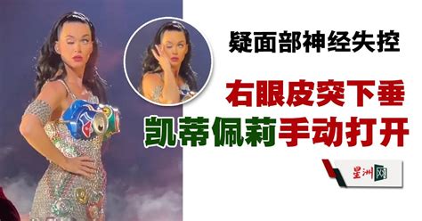 Sin Chew Daily 星洲日報 On Twitter Katyperry 怎么了？（内附视频） 星洲日报 Sinchew