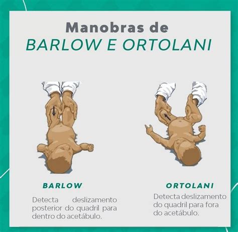 Manobras de Barlow e Ortolani - Enfermagem