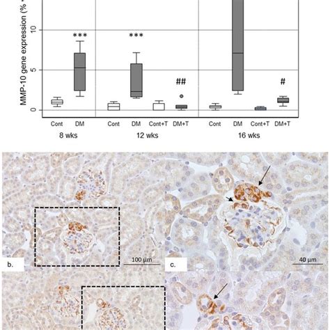 Renal Mmp Gene Expression Panel A Shows A Greater Renal Mmp