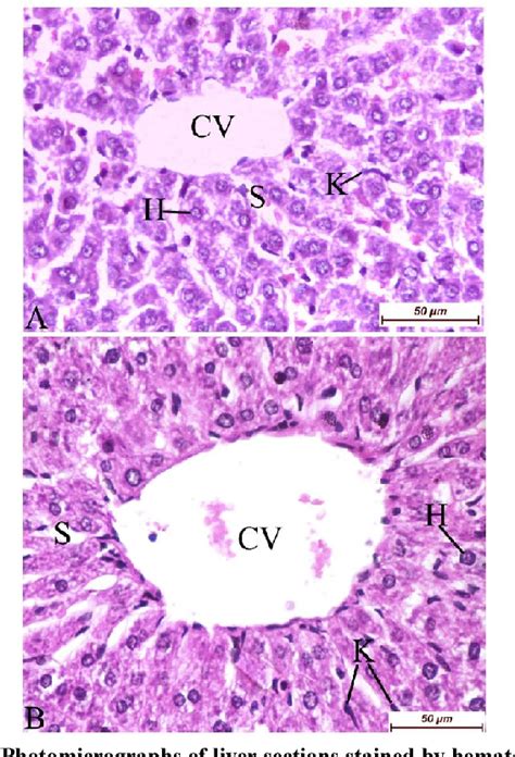 Figure From Modulatory Effect Of Origanum Majorana Extract Against