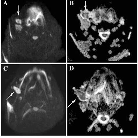 Regional Lymph Node Stations For Lung Cancer Staging 2 With Kind Download Scientific Diagram