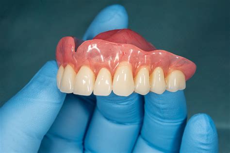 Can Dentures Rebuild Your Smile Springfield Oh