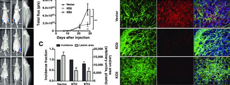 Tumor Derived Alcam Impacts Metastatic Growth But Not Incidence After Download Scientific