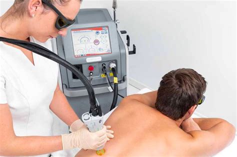 Avantages De L Pilation Laser Du Dos Pour Les Hommes