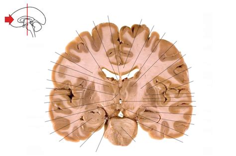 Internal Morphology Axial Slice Diagram Quizlet Hot Sex Picture