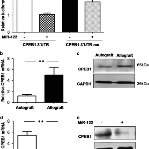 Mir 122 Inhibits The Apoptosis Of Corneal Keratocytes Through The