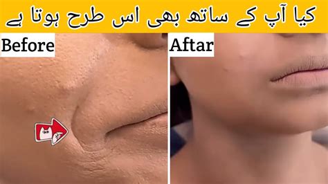 HOW TO STOP FOUNDATION CREASING IN YOUR SMILE LINE Makeup Tricks