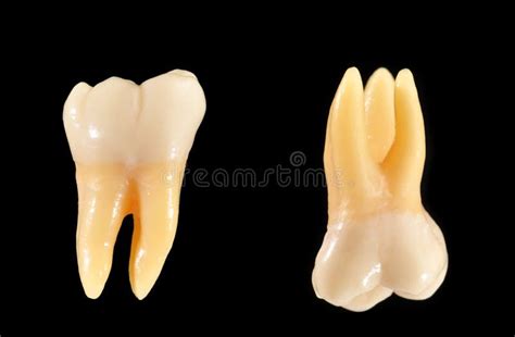 Molar Teeth Isolated On Black Stock Image - Image: 12481847