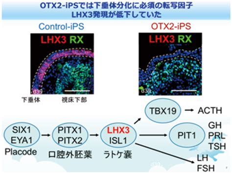 世界初！ヒトips細胞を用いた下垂体疾患モデル作製に成功し発症メカニズムを解明 神戸大学ニュースサイト