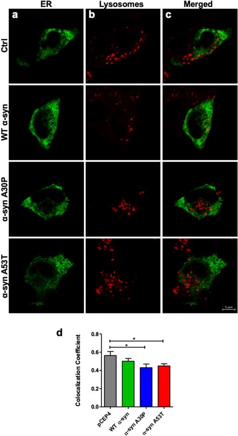 Evaluation Of Colocalization Between Er And Lysosomes The Cells