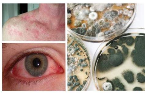 Ultimate Guide to Detecting Mold in Walls: Early Warning Signs and Solutions - Hunter Games Magazine