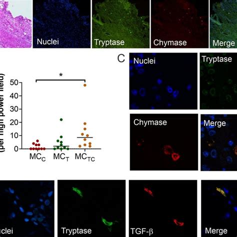 Tryptase And Chymase Positive Mast Cells Are Located At Active