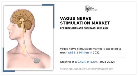 Vagus Nerve Stimulation Market Set To Soar To Million By