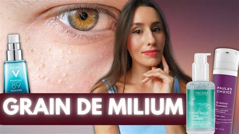 COMMENT ENLEVER LES GRAINS DE MILIUM YouTube