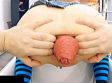 Extreme Anal Prolapse Of Destroyed Ass Of Dirty Bitch ThisVid