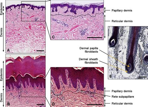 Adult Human Skin Consists Of Epidermis And Dermis The Epidermis Is