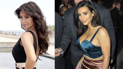 Kim Kardashian Before And After Bum Implants