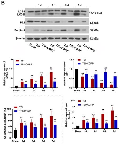 LC3A B Antibody Affinity Biosciences LTD 亲科生物官网