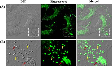 A Dual Targeting Fluorescent Probe For Simultaneous And Discriminative