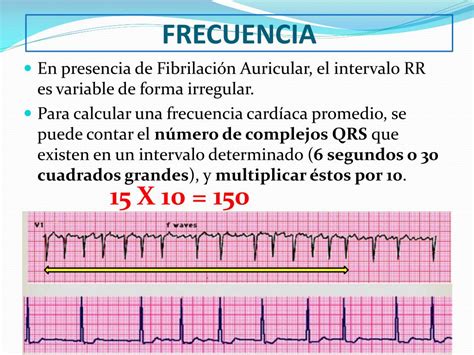 Ppt Lectura E Interpretación Del Electrocardiograma Powerpoint Presentation Id4386507